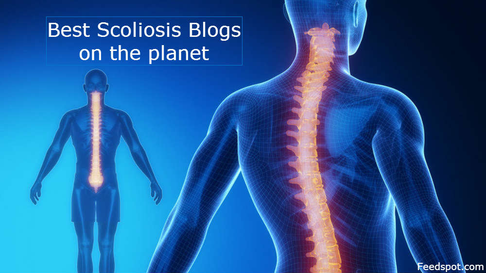 Top 25 Scoliosis Blogs And Websites For People Living With Scoliosis ...