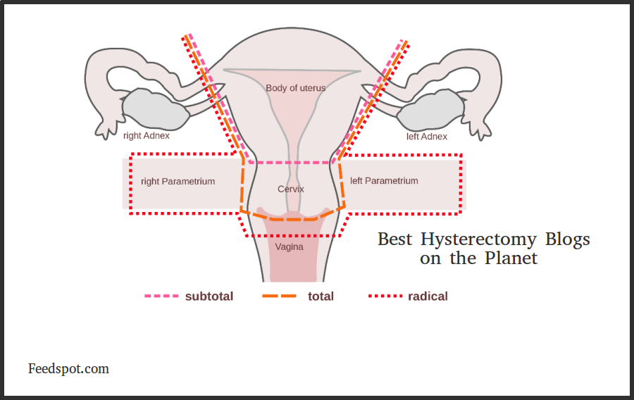 Top 10 Hysterectomy Blogs And Websites Life After