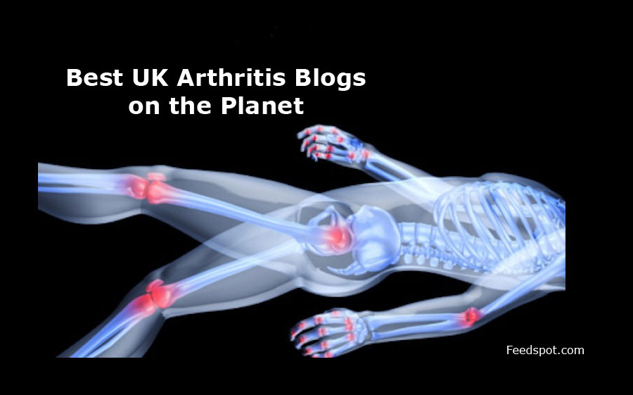 Top 5 UK Arthritis Blogs And Websites To Follow in 2019