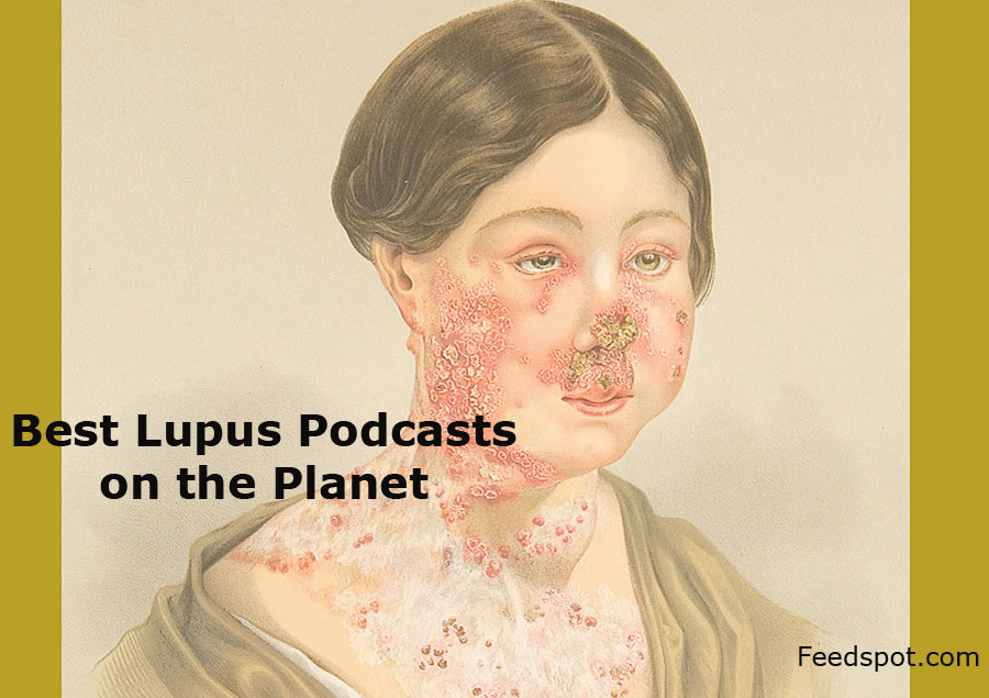 Lupus Podcasts