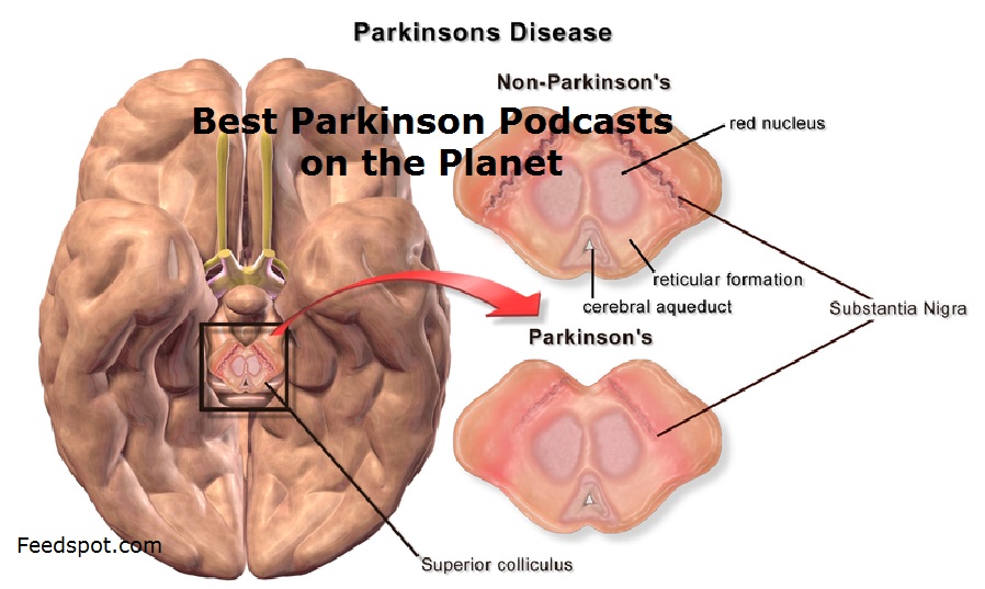 Parkinson Podcasts